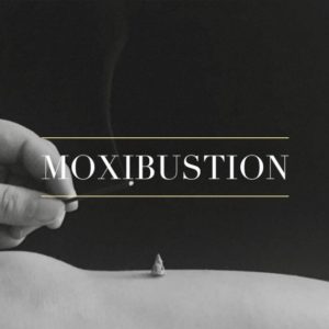 Image of Moxibustion Therapy with Acupuncture Treatment in Kalispell MT